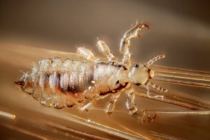 head lice, symptoms and treatments