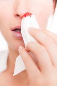 prevention and treatment of nosebleeds
