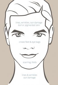 How witch-hazel can help with acne and skin damage.
#HeatherEarles #herbnwisdom #naturalliving #acne #skincare