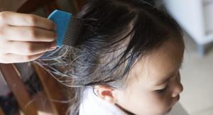 using oil and a nit comb to get rid of lice