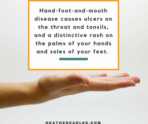 Signs of Hand-foot-and-mouth disease